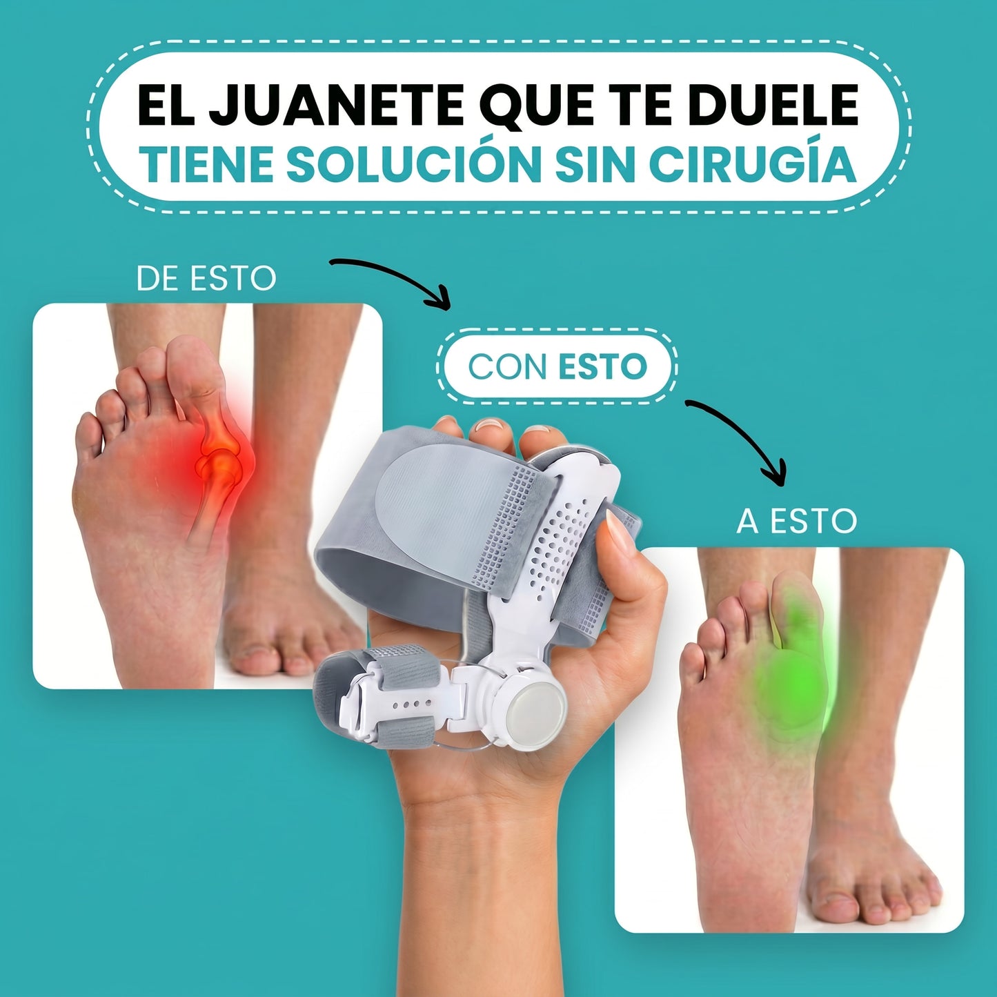 Corrector de Juanetes